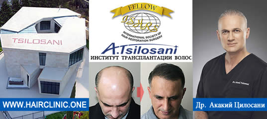 Восстановление бороды -  до и после. Проф. Акакий Цилосани