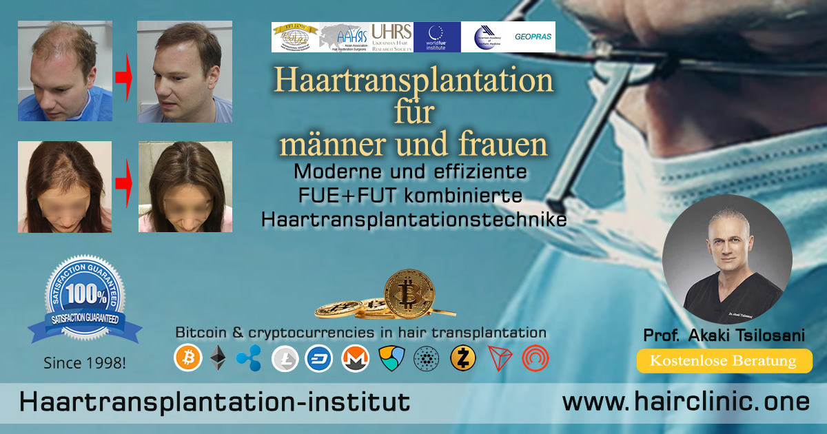 המכון להשתלות שיער