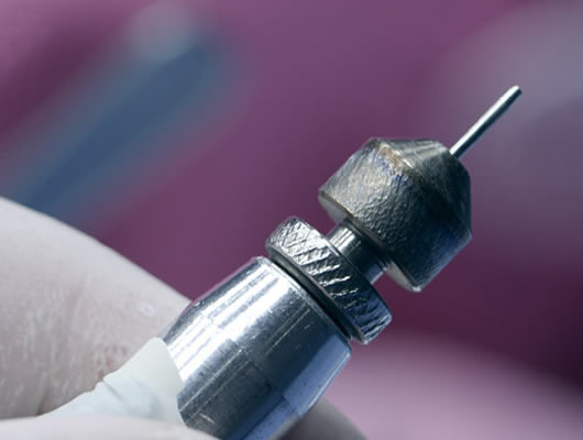 Пересадка волос